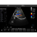 Full Digital Color Doppler Ultrasound Laptop Ultrasound Machine Price Portable 3D Ultrasound Scanner